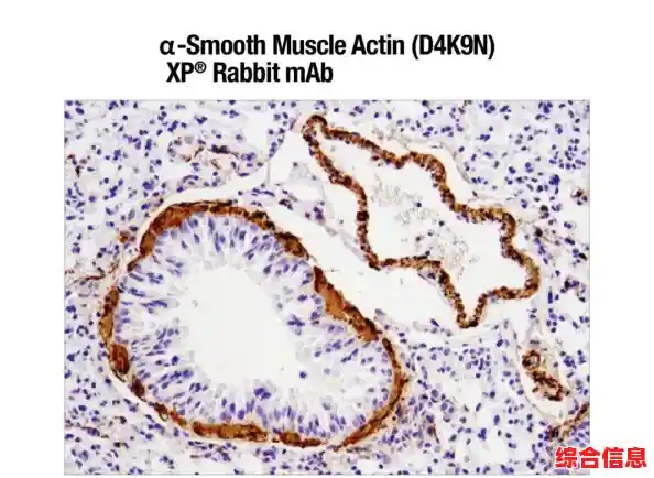 揭秘Windows XP:全面剖析系统的起源发展与功能特点 揭秘Windows XP:全面剖析系统的起源发展与功能特点