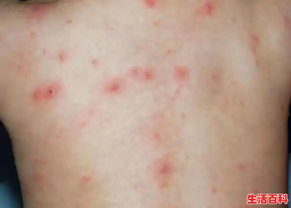 南京出现新冠疫情医护人员连喝7瓶水？（南京有一例新型肺炎）